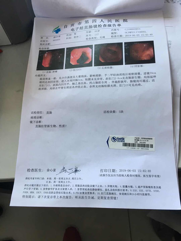 我家公90岁了,上厕所难,去医院检查出来是直肠癌!